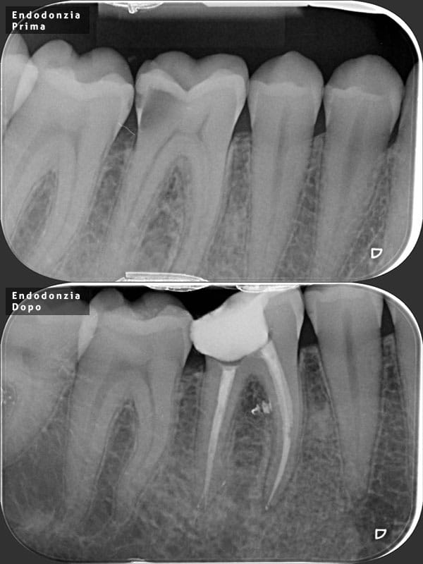 endodonzia-600--2-nuovo