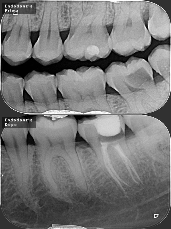 endodonzia-600-nuovo
