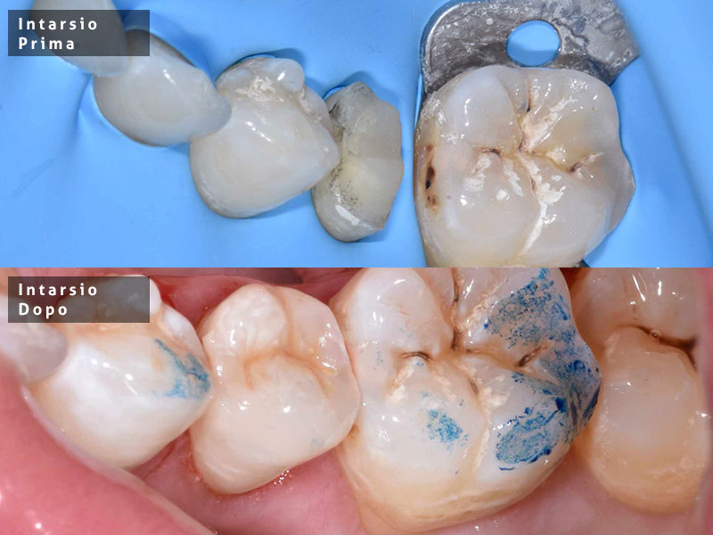intarsi-2